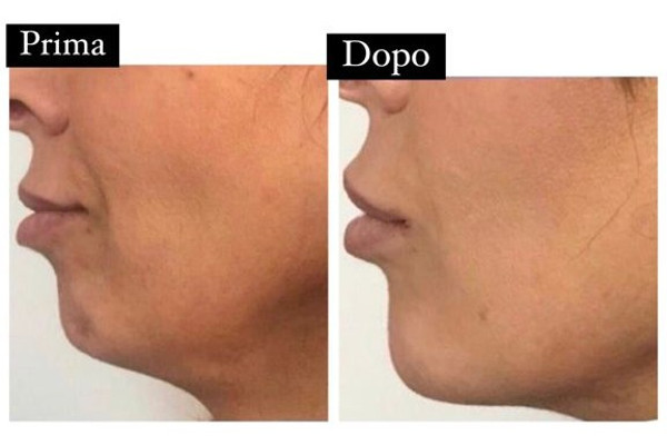 Trattamento Viso di Estetica Avanzata